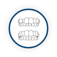 Crossbite / Open Bite